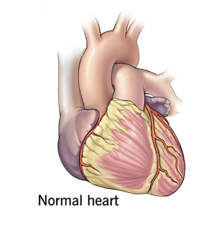 Stem Cell Therapy Cardiovascular diseases treatment