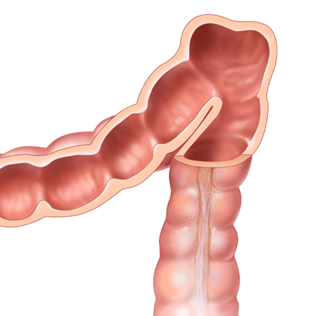 Stem Cells Gastrointestinal Cancer - stem cell tijuana - mesenchymal