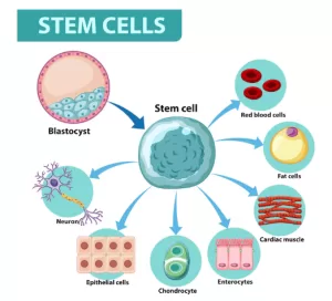 mesenchymal stem cells treatment - stem cell tijuana